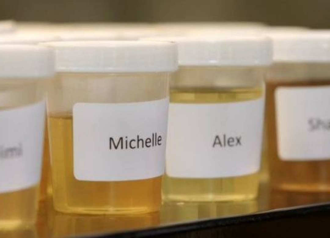 The Great British Urine Test