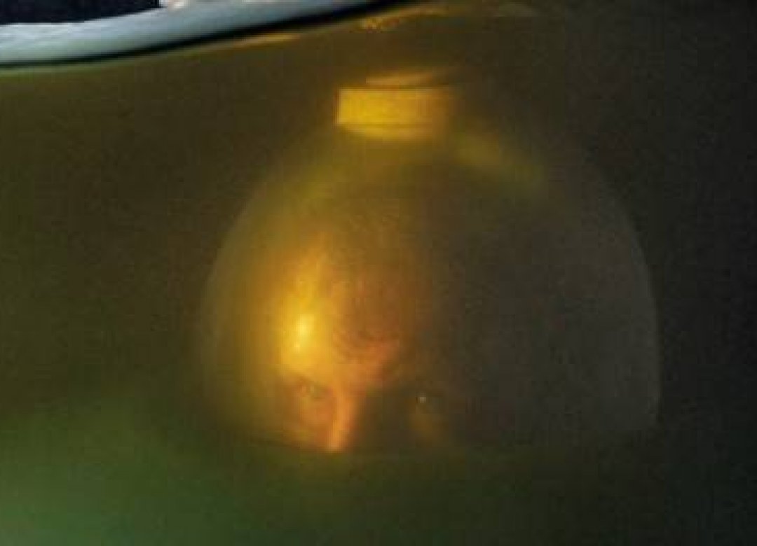 Submarine Man