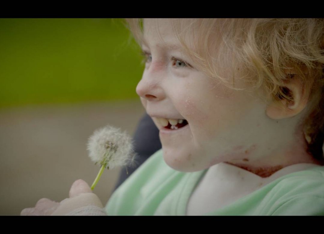Butterfly Child Effect